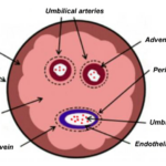 Umbilical Wharton’s Jelly MSCs